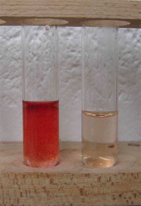 sudan 4 test for lipids|Sudan IV Staining: A Procedure for Staining Lipid .